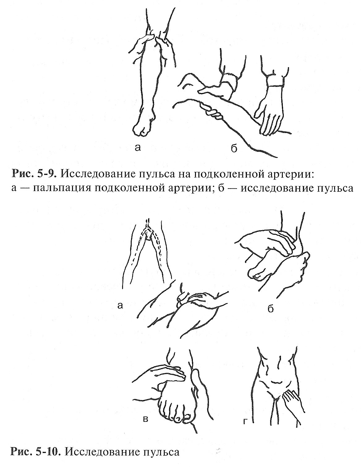 Исследование пульса на периферических артериях норма