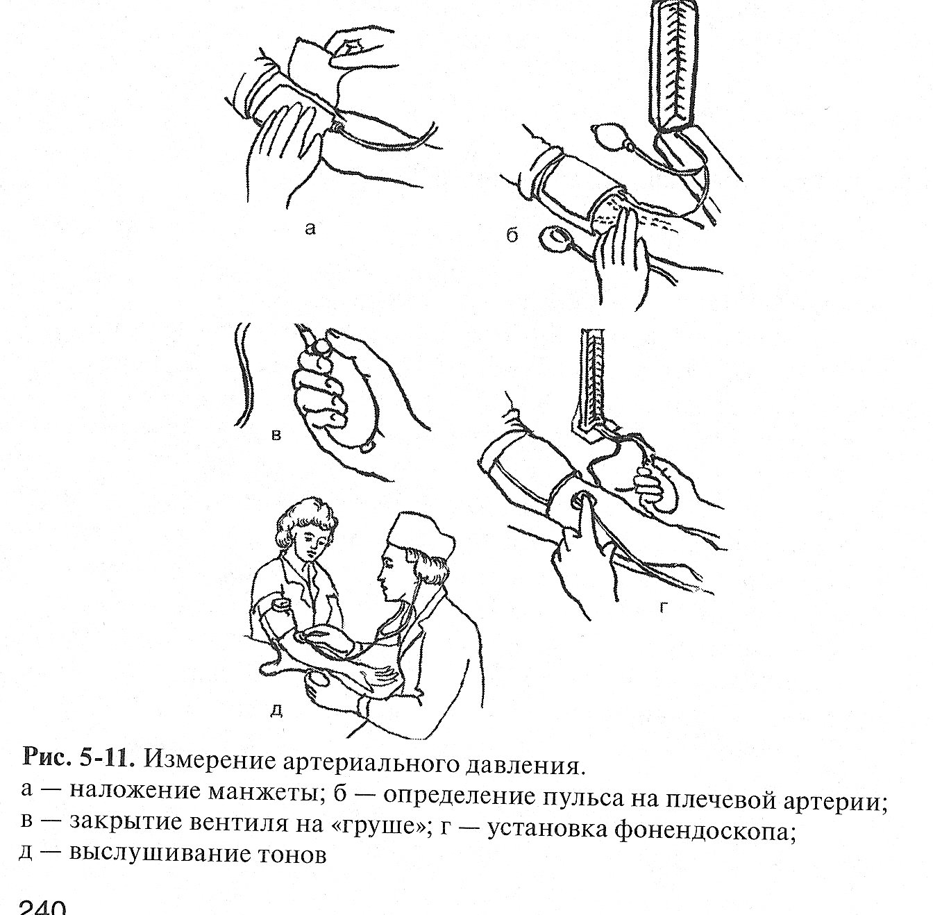Алгоритм оказания измерения артериального давления