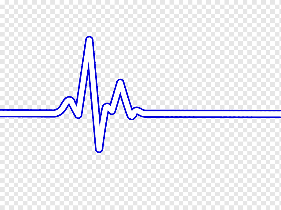 ECG Heart rate
