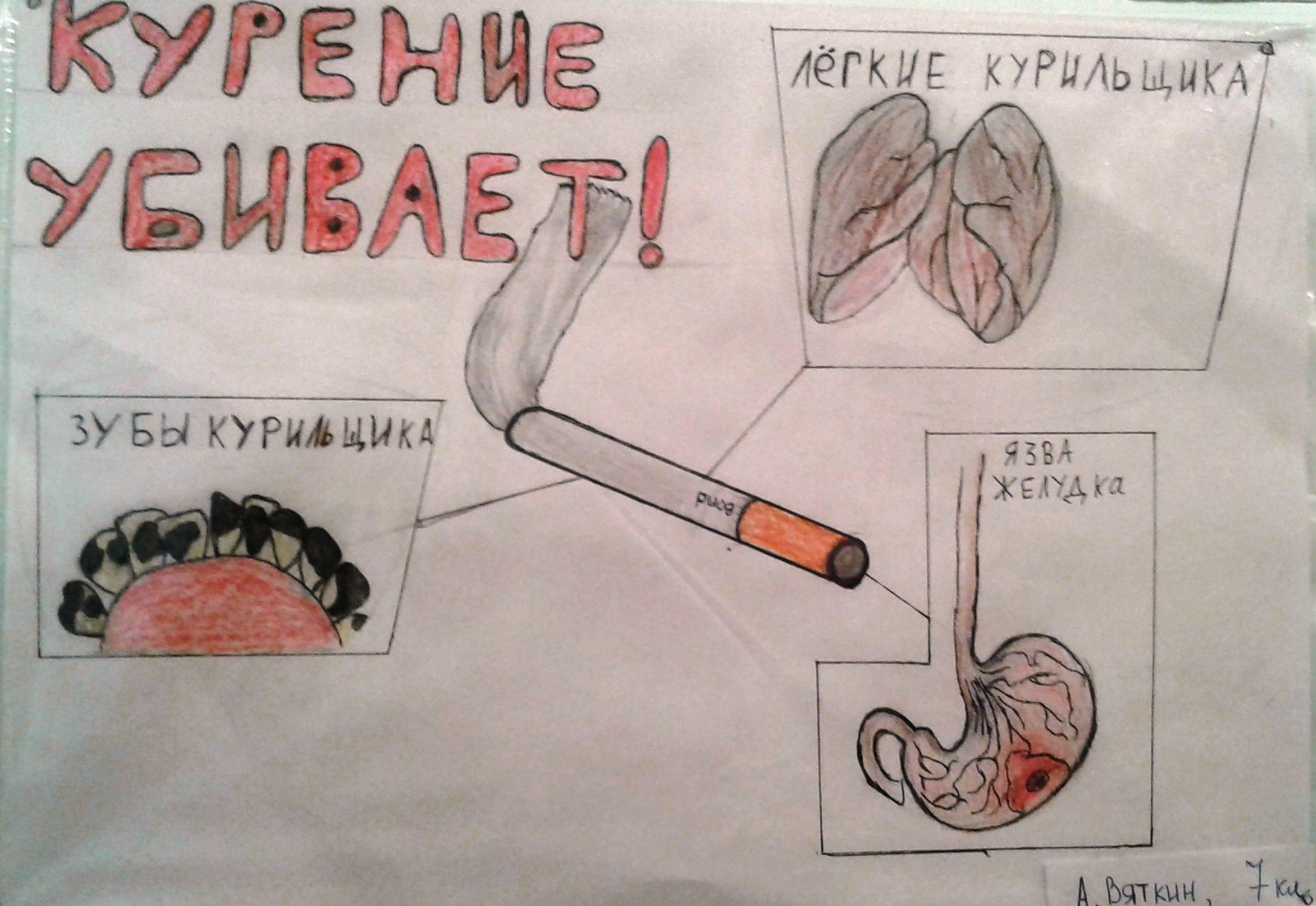 Плакат «вред курения»