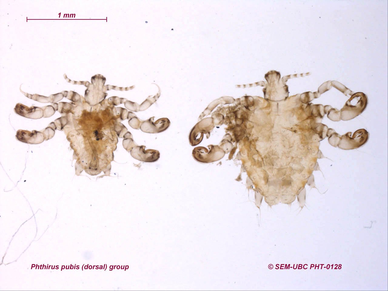 Лобковая вошь (Phthirus pubis). Строение