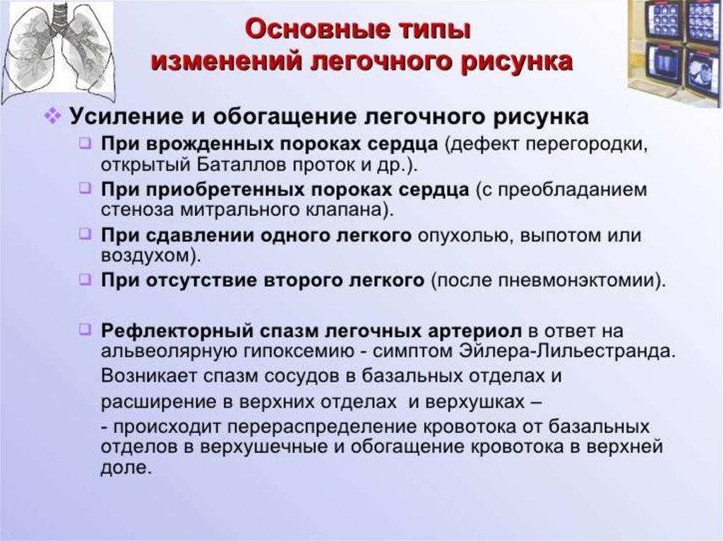 Обогащение легочного рисунка (50 фото) скачать бесплатно