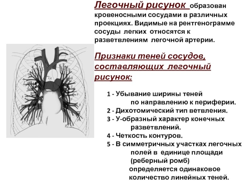 Обогащение легочного рисунка (50 фото) скачать бесплатно