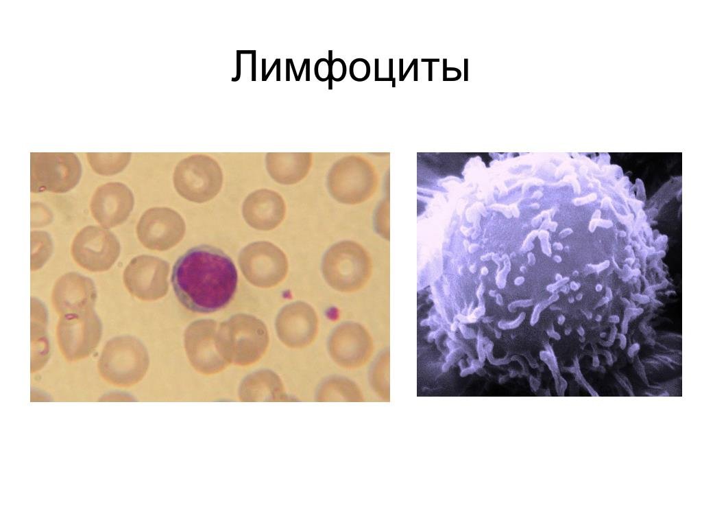 Рисунок лимфоцит (50 фото) скачать бесплатно